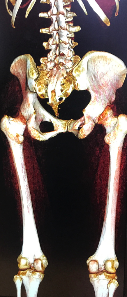 lower body